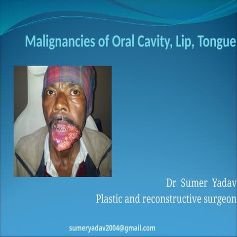 oral cavity  malignancy recent  ppt.pptx