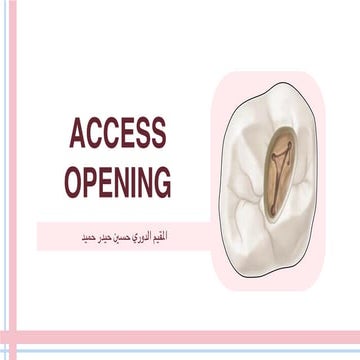 Access opening of molar teeth | PDF