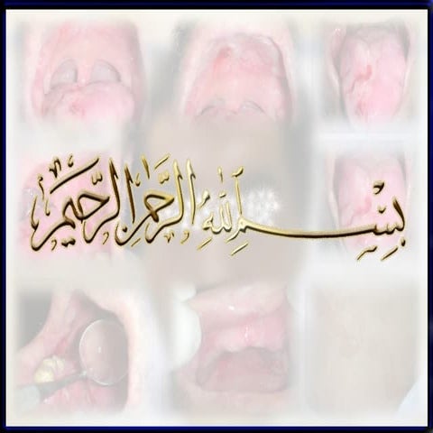 Oral medicine case behcet disease