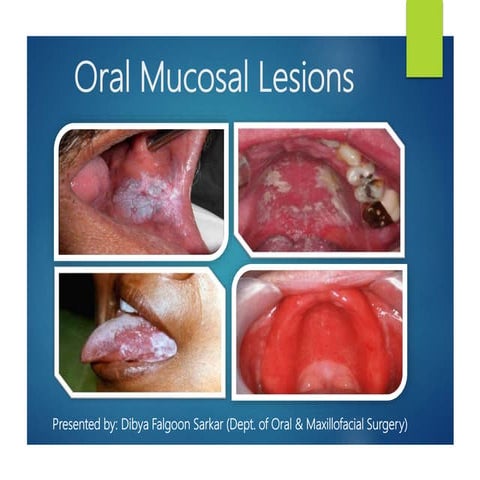 Oral mucosal lesions