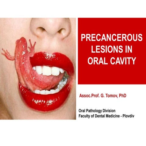 precancerous lesions in oral cavity