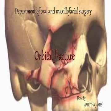 Orbital fracture