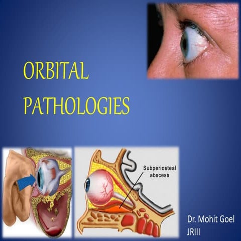 Orbital pathologies radiology