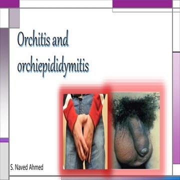 Orchitis & epididymitis