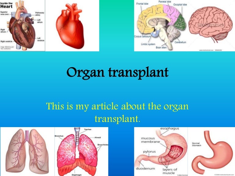 Organ transplant