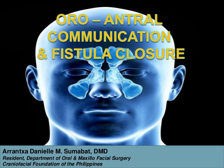 Oro antral communication