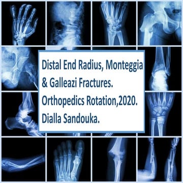 Distal end radius, monteggia and galleazi fractures.