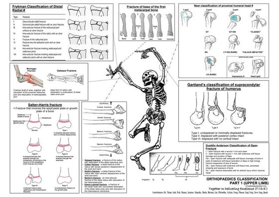 Digitized manual palpation: a new method of evaluating posture and its ...