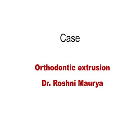 Orthodontic extrusion