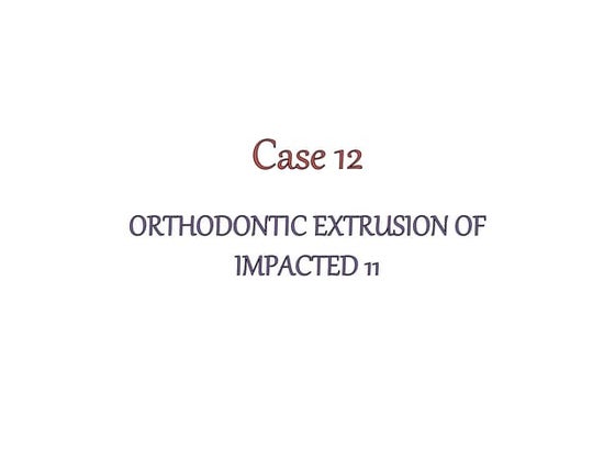 Orthodontic extrusion of impacted tooth | PPTX