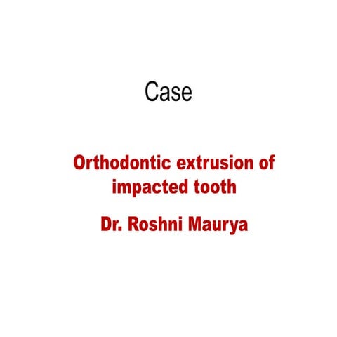 Orthodontic extrusion of impacted tooth