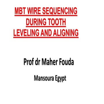 MBT wire sequence  during  orthodontic alignment and leveling