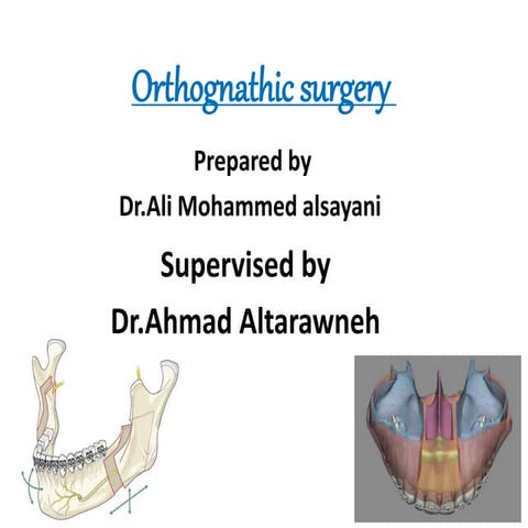 Orthognathic surgery