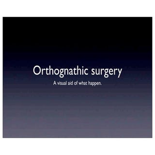 Orthognatic surgery chirurgie ortho...
