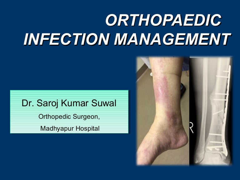 Orthopaedic infection management dr.saroj