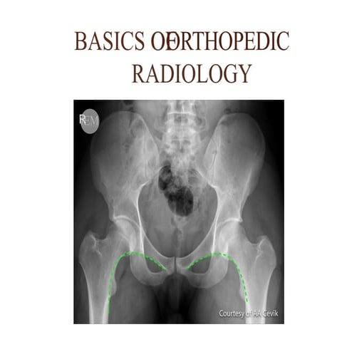 9- BASICS OF ORTHOPEDIC RADIOLOGY.ppt
