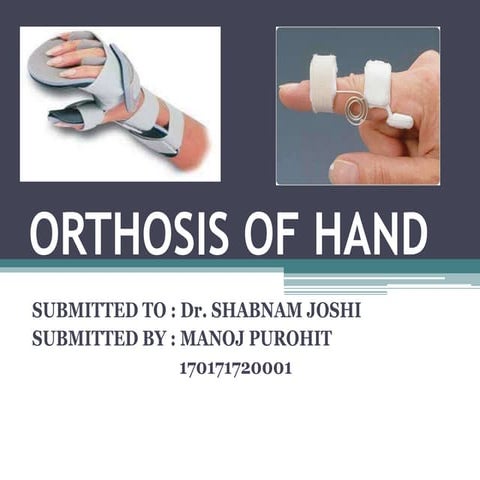 Orthosis of hand ppt