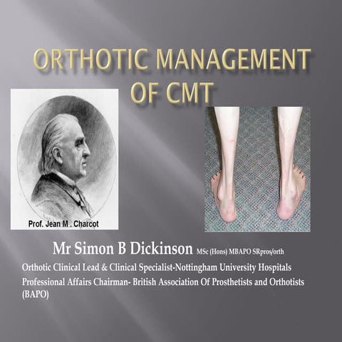 Orthotic Management of Charcot Marie Tooth
