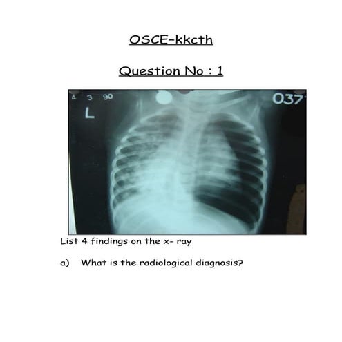 OSCE Pediatrics KKCTH