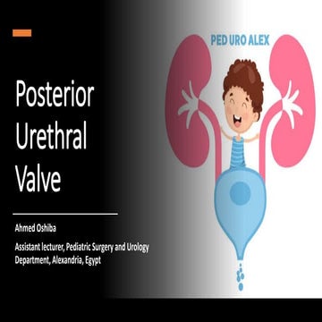 posterior urethral valve..  ahmed oshiba