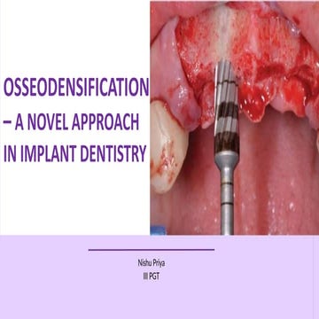 osseodensification.pptx