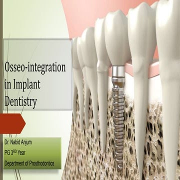 Osseointegration in Dental Implants