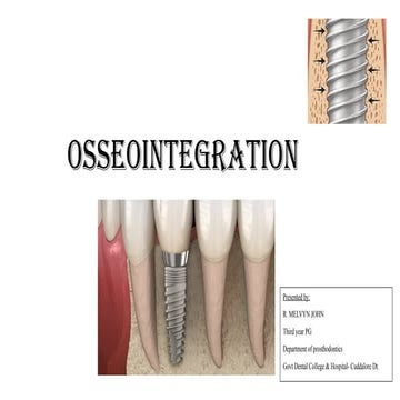 Osseointegration in Dental Implants | PPTX