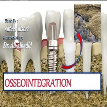 Comprehensive Overview of Osseointegration in Dental Implants: Process ...
