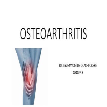 Osteoarthritis And Management Plan Pptx