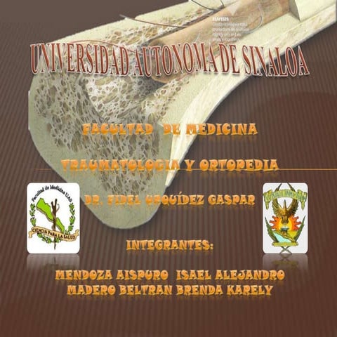 Osteogénesis imperfecta