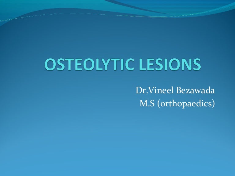 Osteolytic lesions of Bone
