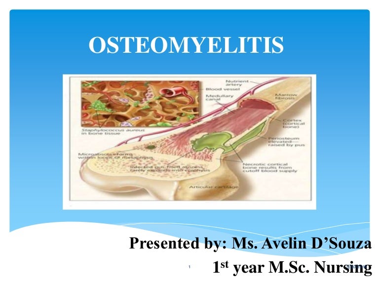 Osteomyelitis