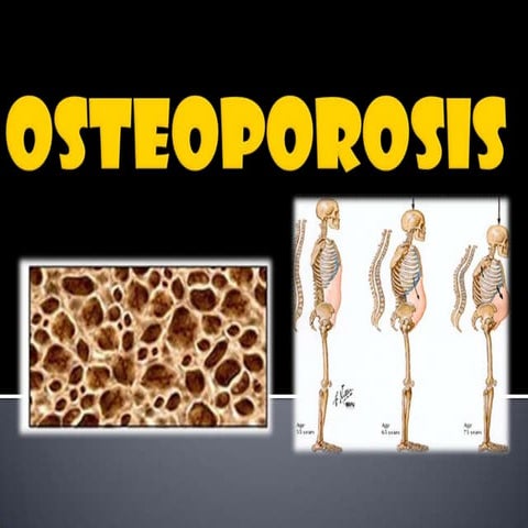 Osteoporosis