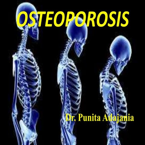 Osteoporosis And Physiotherapy Management