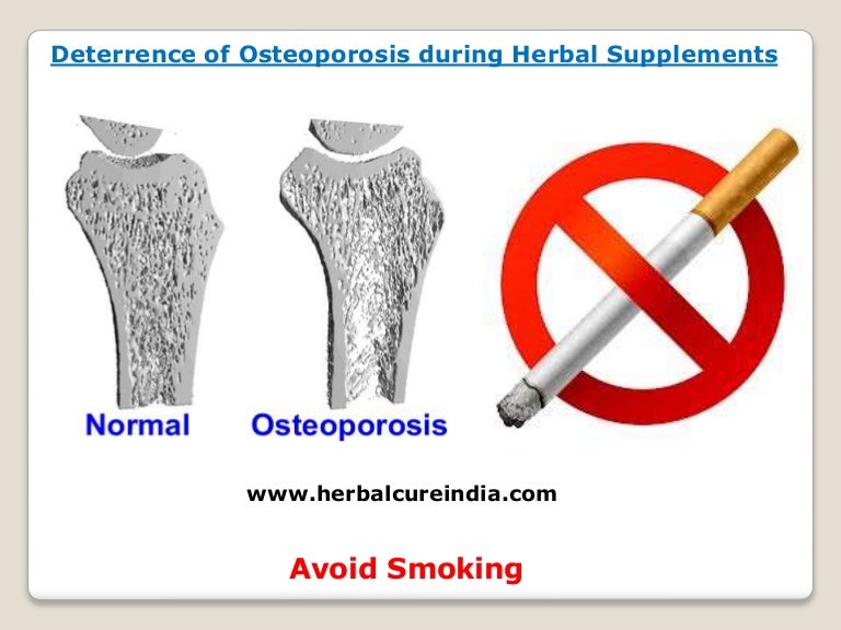 Deterrence of Osteoporosis during Herbal Supplements