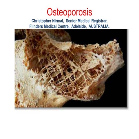 Osteoporosis