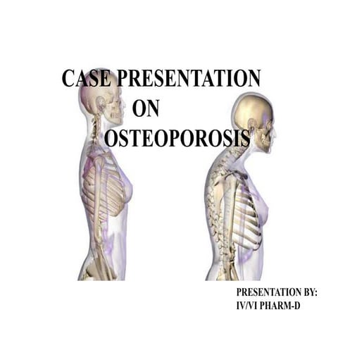 case presentation on  Osteoporosis 
