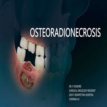 OSTEORADIONECROSIS.pptx
