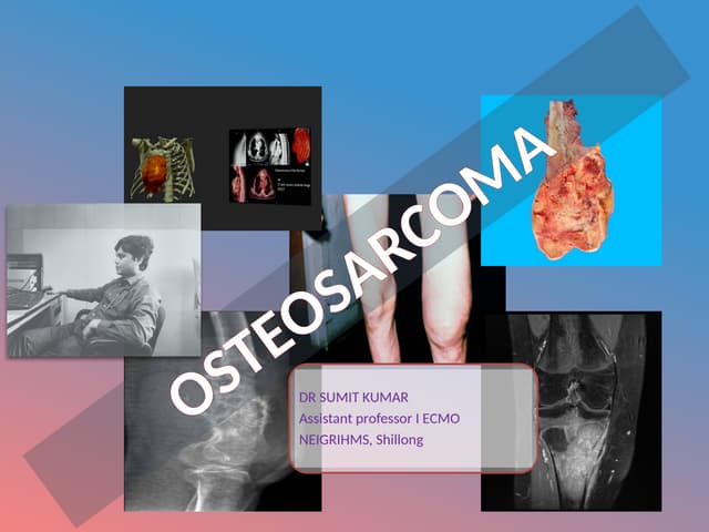 Osteosarcoma:-DIAGNOSIS AND TREATMENTpptx