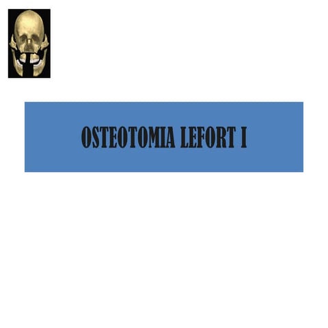 Osteotomia lefort i