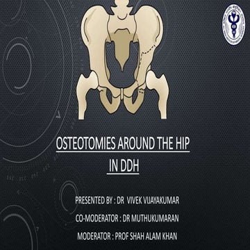 IHDI Classification of Hip Dysplasia | PPTX
