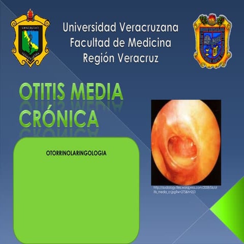 Otitis media crónica
