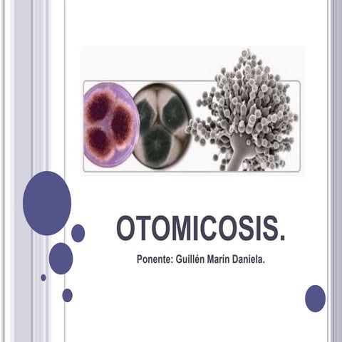 OTOMICOSIS exposición.