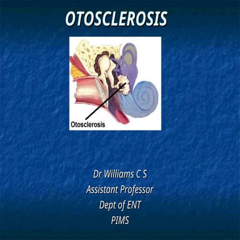 Otosclerosis -Disease of Ear- Otorhionolaryngology