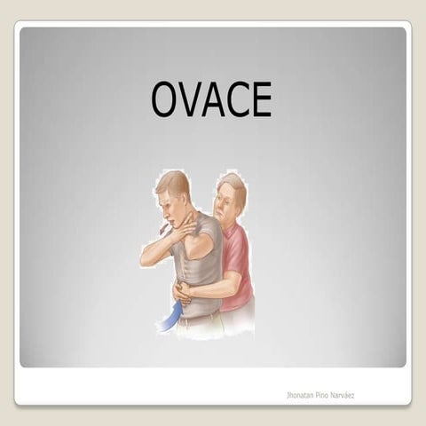 Ovace | PPTX