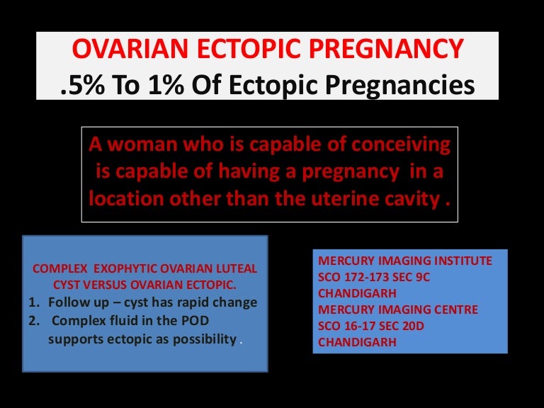 Ovarian ectopic pregnancy