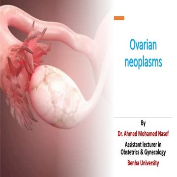 ovarian neoplasm.pptx