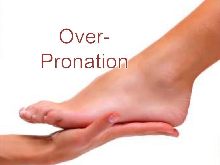 slight overpronation