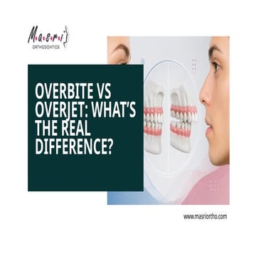 Overjet/Overbite | PDF