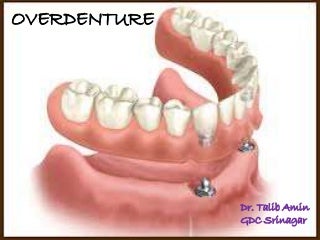 My Ex Seems So Happy With His Rebound: My Ex Jumped Into Another Relationship